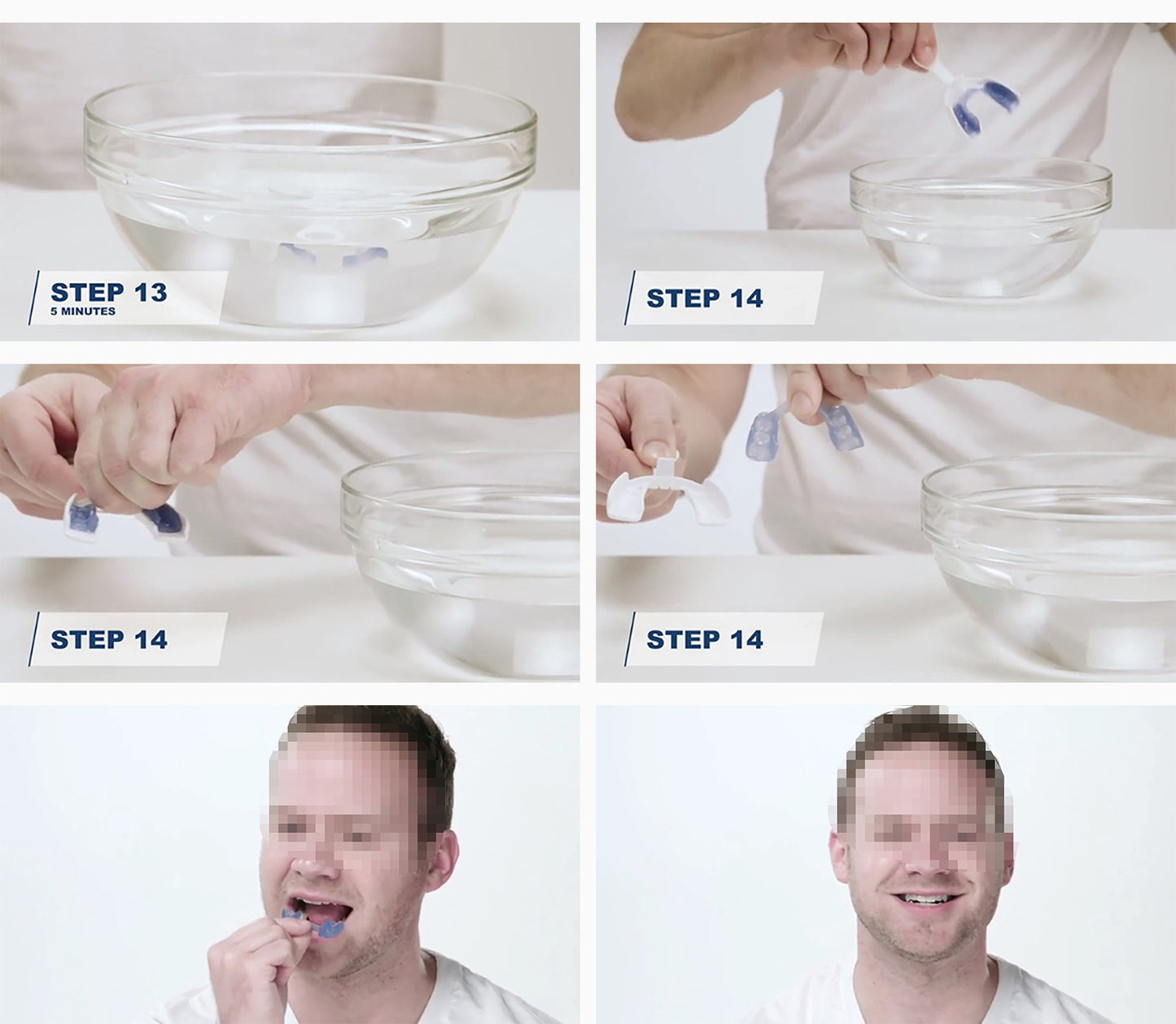 Dental Guard for Nighttime Teeth Grinding with Tray